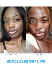 Load image into Gallery viewer, Combination Skin Turmeric Bundle | Dark Spots